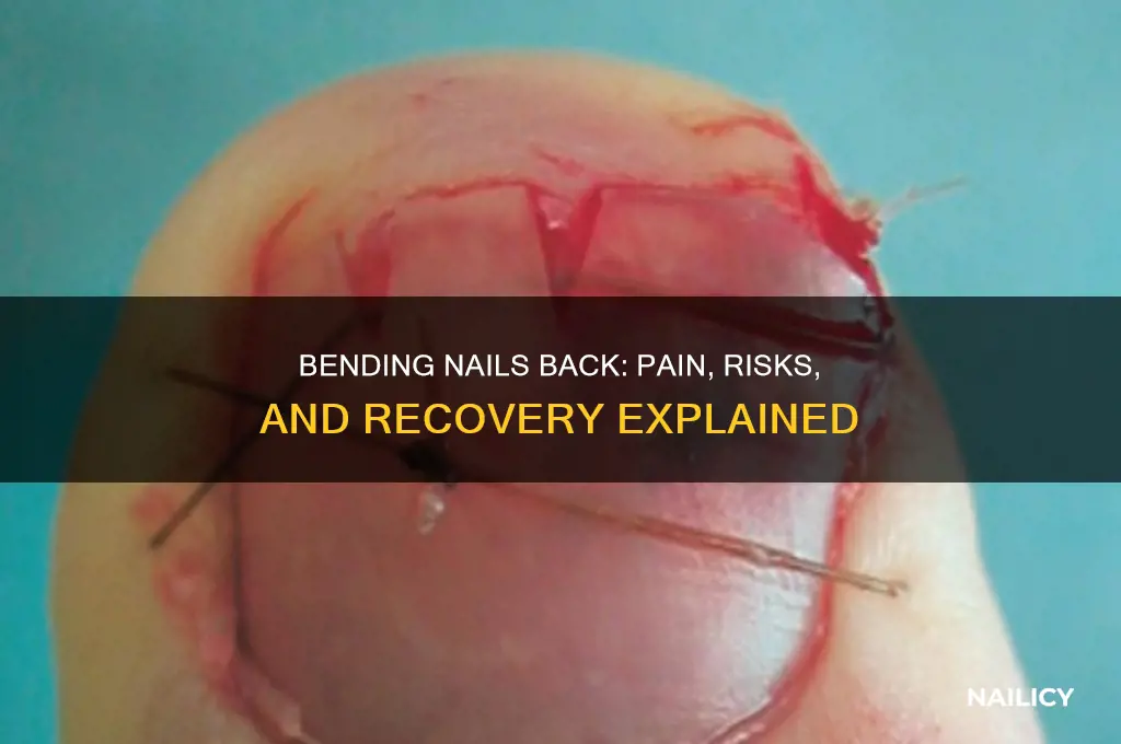 what happens when you bend your nail back