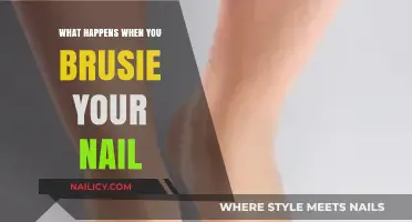 Bruised Nails: Causes, Symptoms, and Healing Process Explained