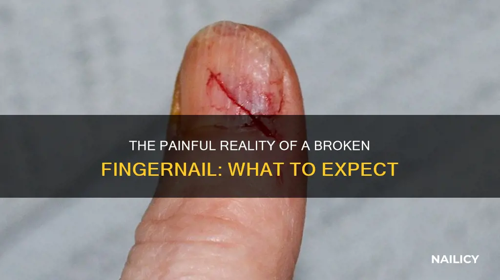 what happens when you smash your finger nail