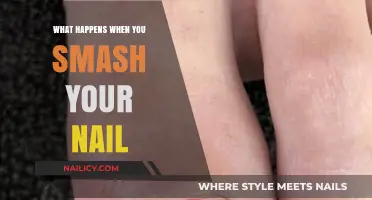 Smashing Your Nail: Pain, Treatment, and Recovery Explained