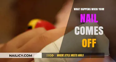 Nail Trauma Explained: What Happens When Your Nail Comes Off