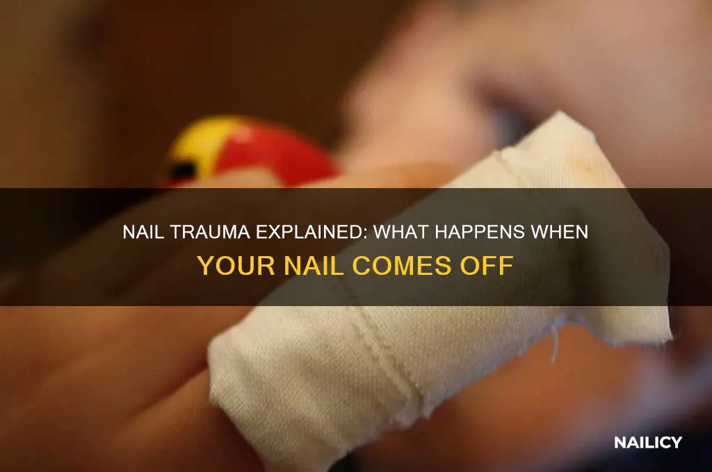 what happens when your nail comes off