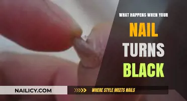 Black Toenail Causes: Understanding Discoloration, Pain, and Treatment Options