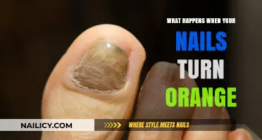 Why Your Nails Turn Orange: Causes, Concerns, and Solutions Explained