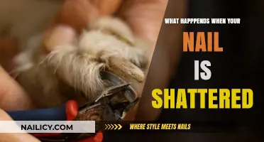 Shattered Nail Crisis: What Happens and How to Heal Quickly