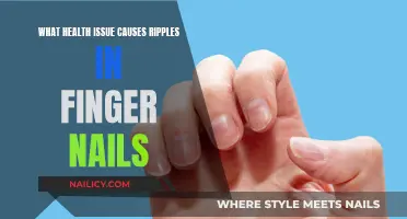 The Mystery of Rippling Fingernails: Unveiling Health Secrets