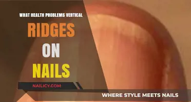 Vertical Nail Ridges: Uncovering Hidden Health Issues and Causes