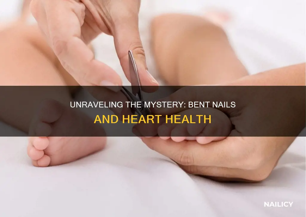 what heart condition is related to bent finger nails