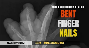 Heart Health and Bent Fingernails: What's the Connection?