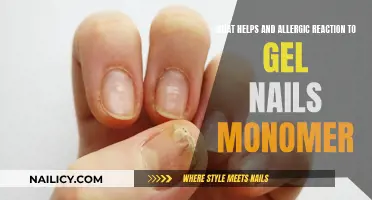 Gel Nails: Allergic Reaction Relief and Prevention