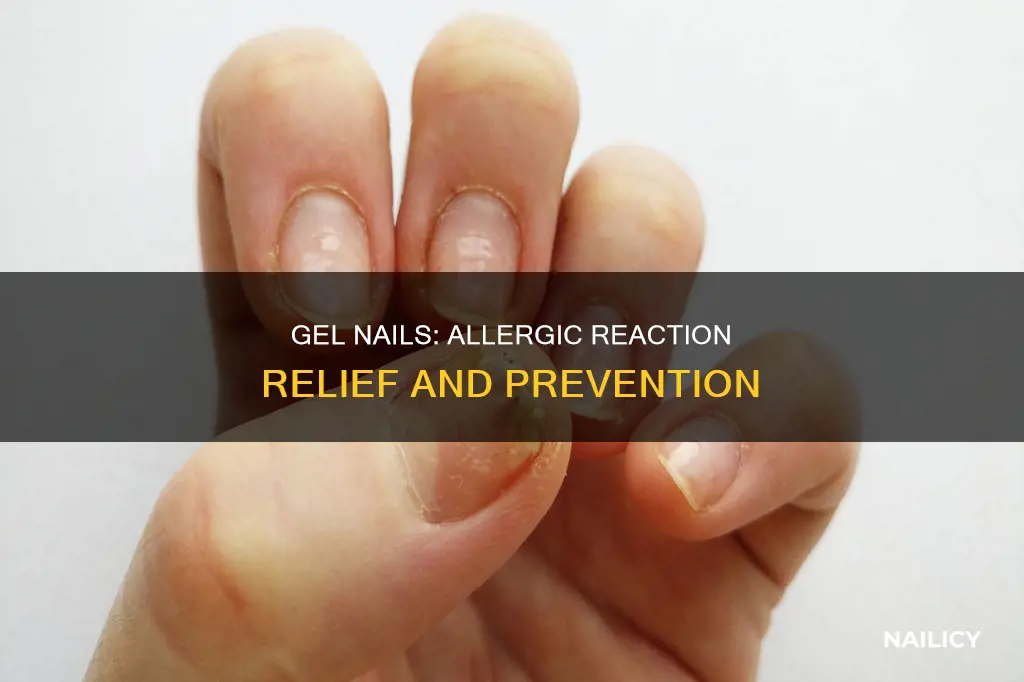 what helps and allergic reaction to gel nails monomer
