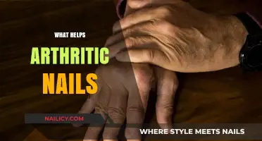 Nourishing Solutions: How to Strengthen and Soothe Arthritic Nails