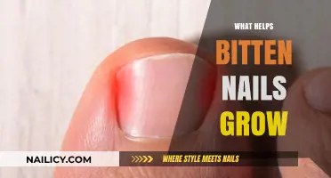 Heal and Grow Nails After Biting