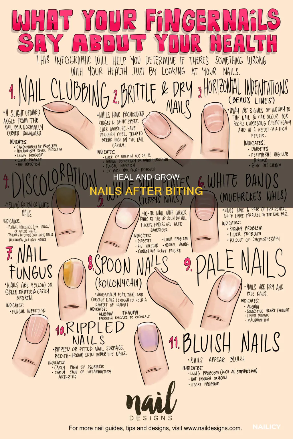 what helps bitten nails grow