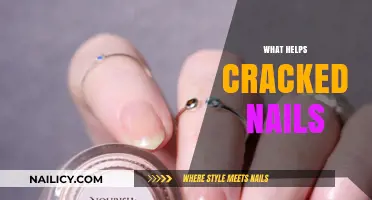 Nourish Your Nails: Effective Remedies for Cracked Cuticles