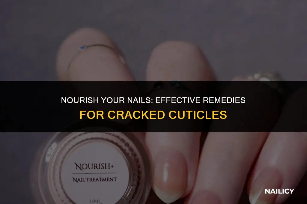 what helps cracked nails
