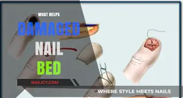 Revitalize Your Nails: Effective Remedies for Damaged Nail Beds