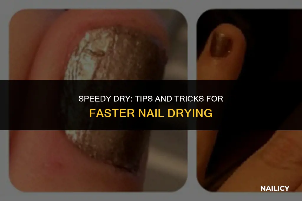 what helps dry nails