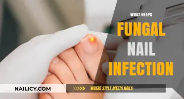 Effective Remedies for Fungal Nail Infections: A Comprehensive Guide