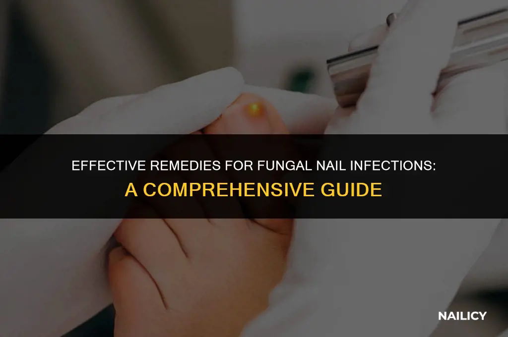 what helps fungal nail infection