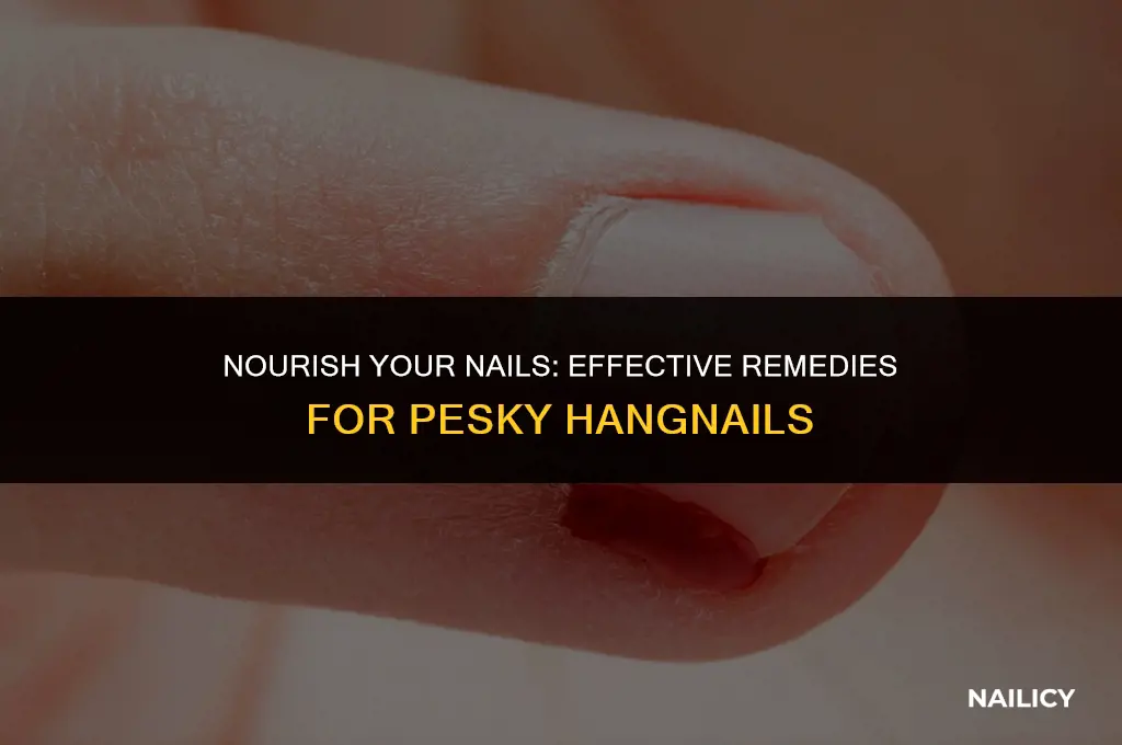 what helps hang nails