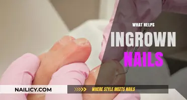 Effective Remedies and Prevention Tips for Ingrown Nails