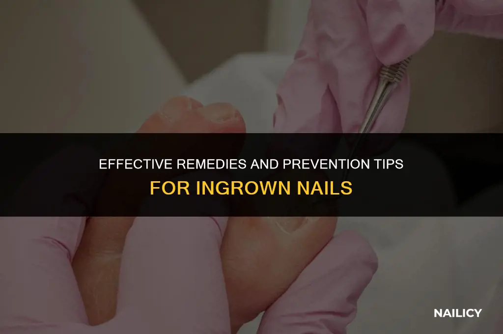 what helps ingrown nails