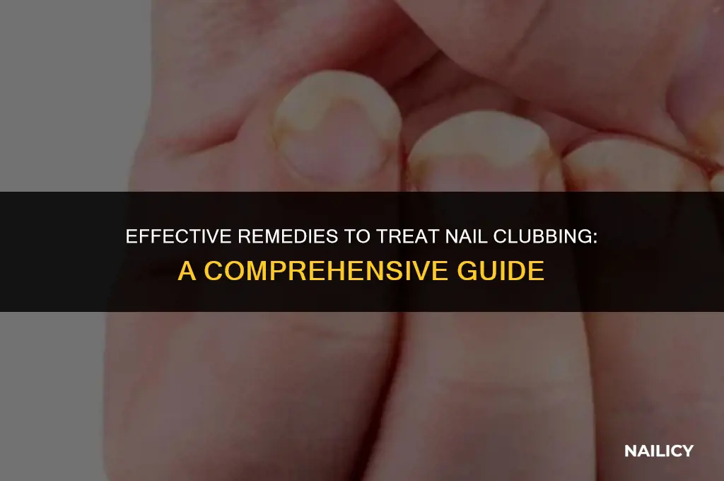 what helps nail clubbing