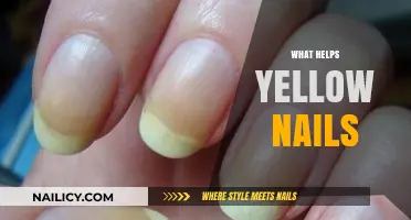 Revive Your Nails: Natural Remedies for Yellowing Fingernails