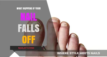 Nail Falls Off: Causes, Treatment, and Recovery Explained