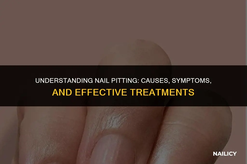 what ia nail pitting