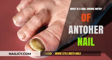 The Mystery of Nail Growth: Double Trouble