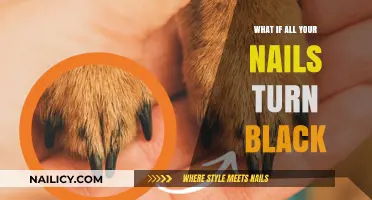 Black Nails: Causes, Concerns, and When to Seek Medical Help