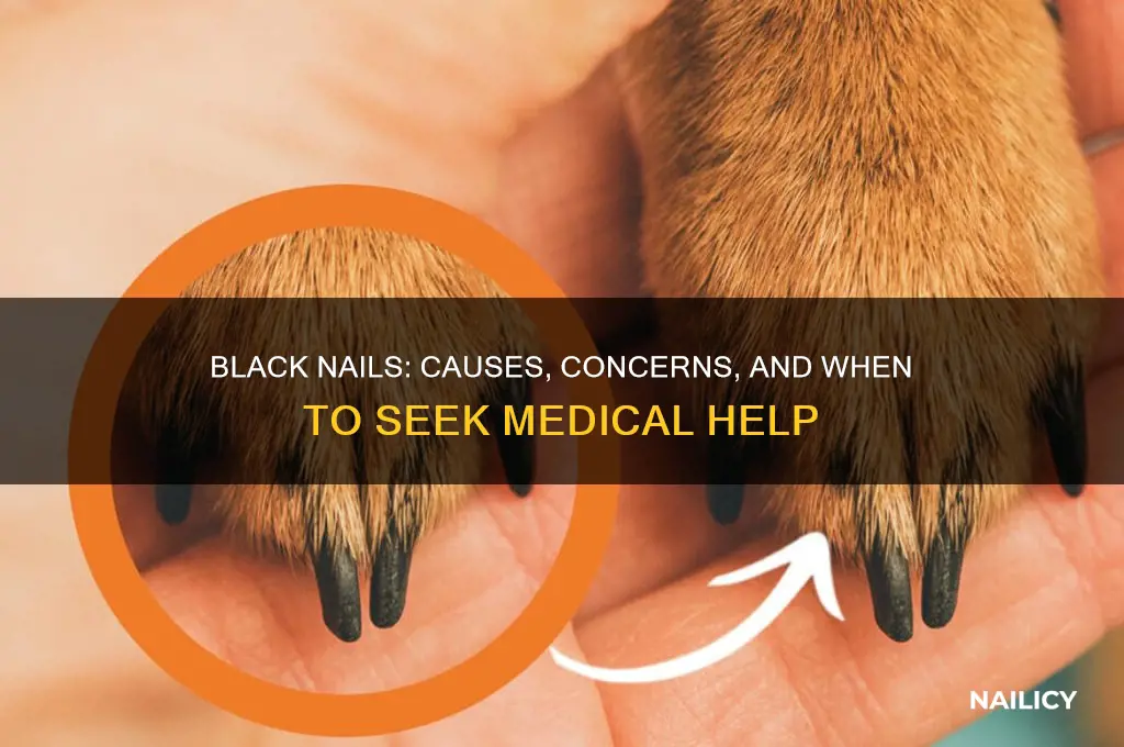 what if all your nails turn black