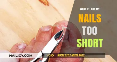 Nail Woes: When Trimming Nails Go Wrong