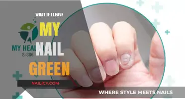 Why Leaving Your Nail Green Could Be a Hidden Health Risk