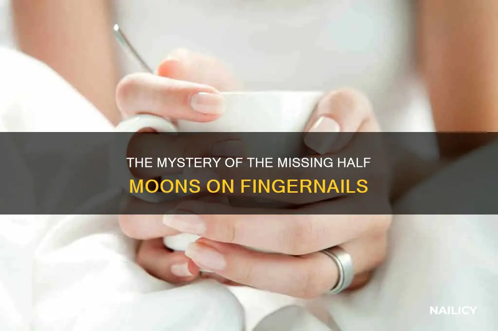 what if my finger nails dont have half moons
