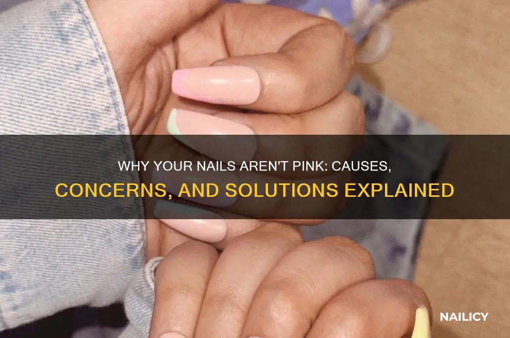 what if my nails are not pink