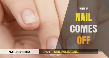 Nail Loss Chronicles: What to Do When Your Nail Comes Off