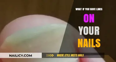Lines on Your Nails: Causes, Concerns, and When to Seek Advice