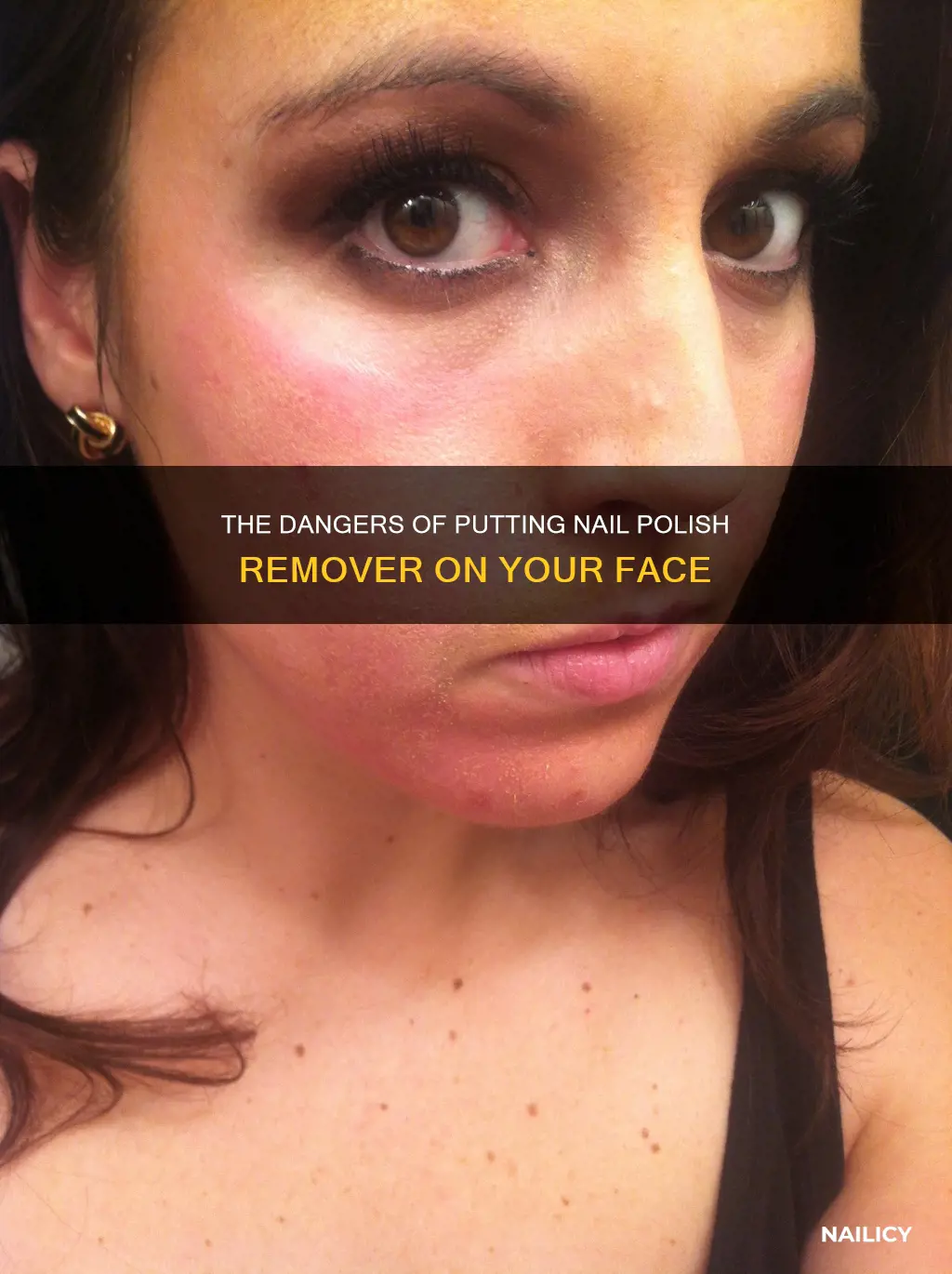 what if you put nail polish remover on your face