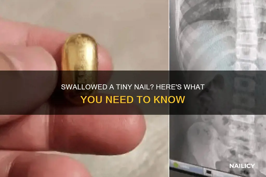 what if you swallow a tiny nail