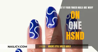 The Mystery of Wavy Fingernails: One Hand, Many Questions