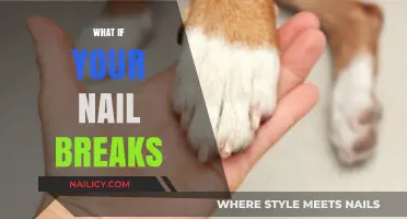 Nail SOS: What to Do When Your Nail Breaks