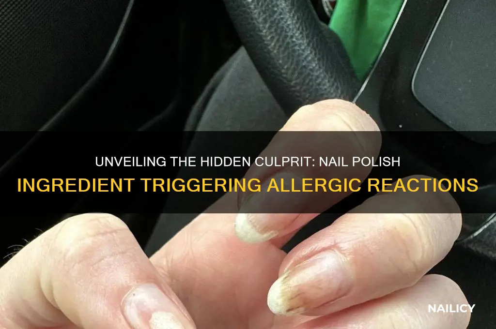 what ingredient in nail polish can cause an allergic reaction
