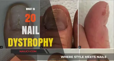 Understanding Nail Dystrophy: Causes, Symptoms, and Treatments