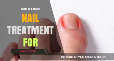 Understanding Adess Nail Treatment: Benefits, Process, and Aftercare Explained