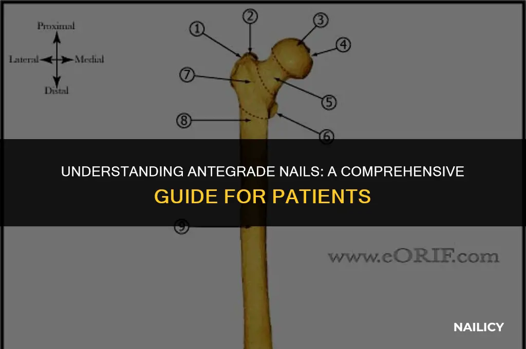 what is a antegrade nail