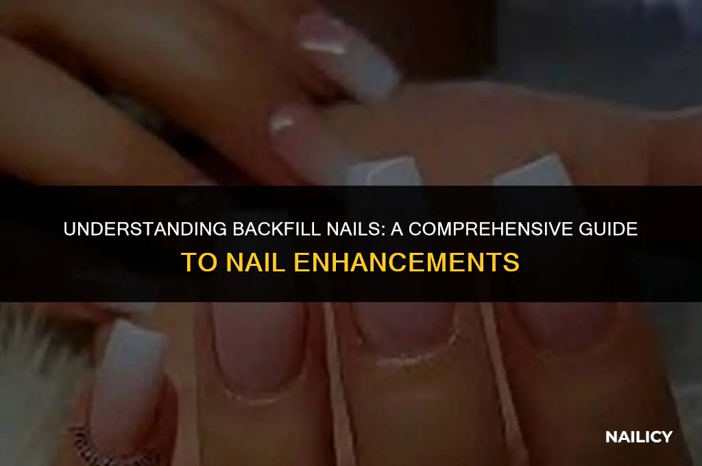 what is a backfill nails
