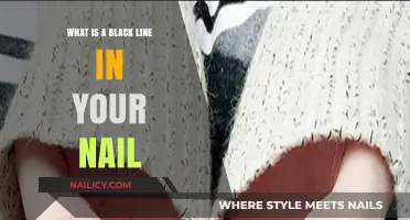 Understanding the Black Line in Your Nail: Causes and Concerns